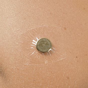 Aimants thérapeutiques diamètre 11 et 15 mm - Auris