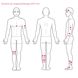 Therapeutic magnets diameter 11 and 15 mm - Auris