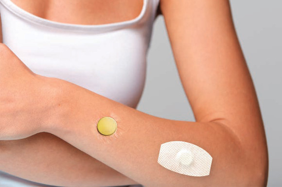 Adhesives for loose fitting magnetic magnets - Auris