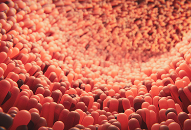 Crohn's disease: an enigma?