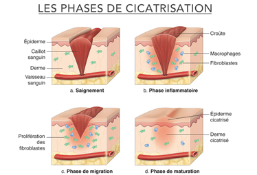Cicatrisation : comment la magnétothérapie peut favoriser un processus naturel